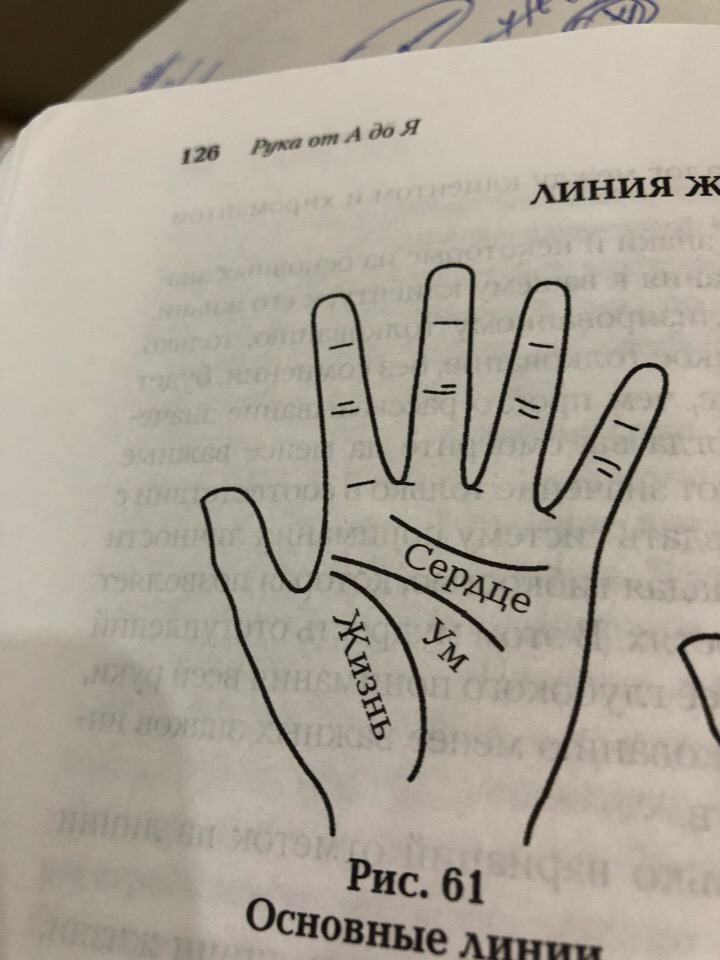 Что означает разрыв на линии жизни на руке - стоит ли переживать?